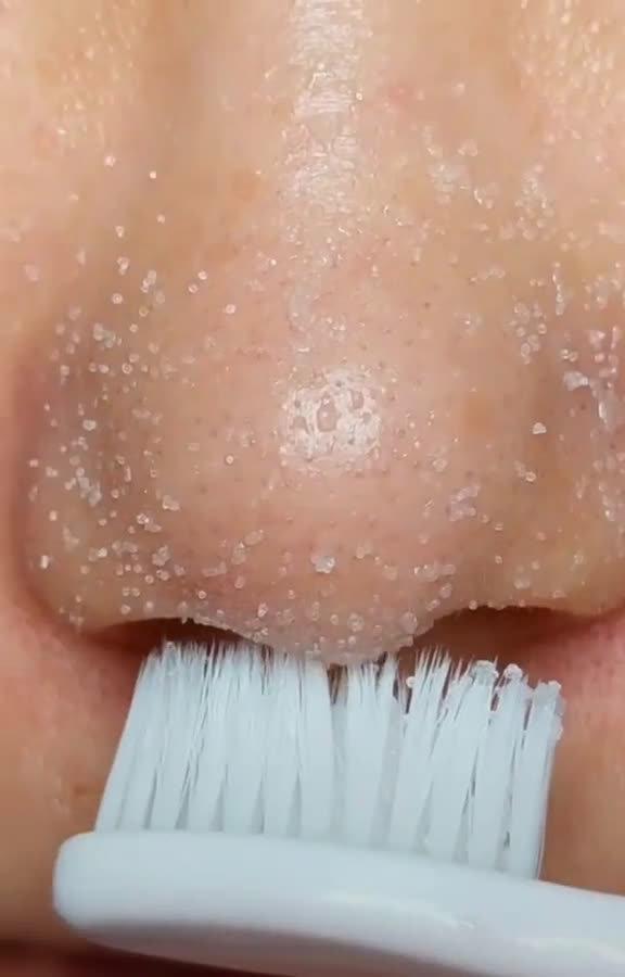 牙膏去黑頭小妙招，輕松解決肌膚問(wèn)題，牙膏去黑頭小妙招，輕松解決肌膚問(wèn)題，重塑肌膚光彩