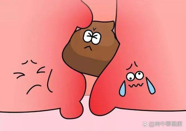 肛門口堵了一坨干硬的大便怎么辦？——便秘的解決方法與預(yù)防策略，解決便秘難題，肛門口干硬大便堵塞的解決方法與預(yù)防策略