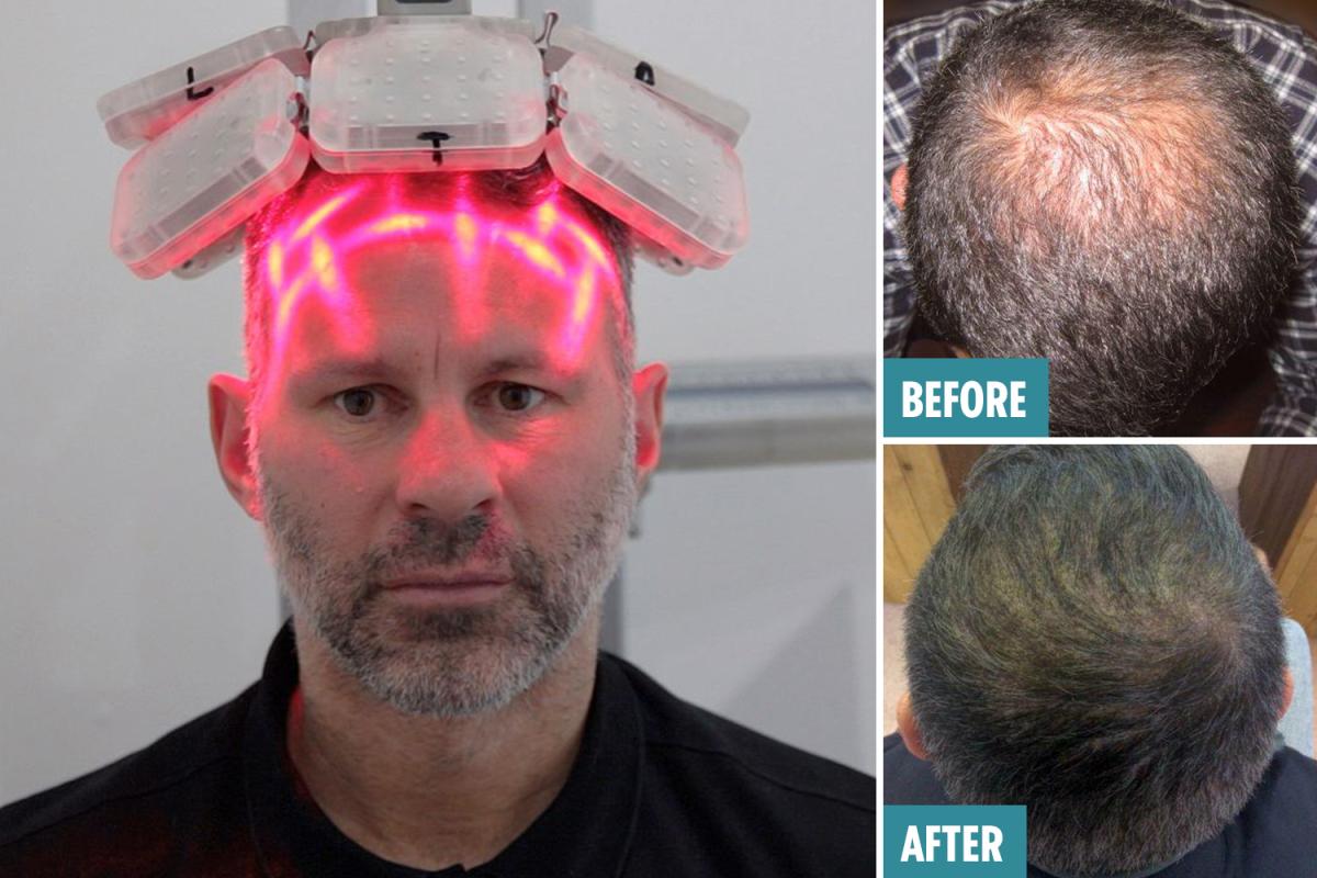 激光手術(shù)費用詳解，多少錢一次？，激光手術(shù)費用全面解析，手術(shù)費用究竟是多少？