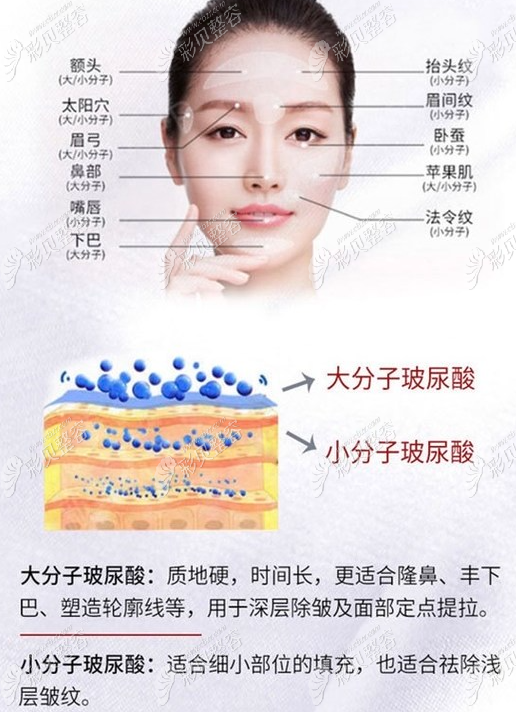 玻尿酸的作用與功效，深入了解玻尿酸的奧秘，玻尿酸的作用與功效揭秘，深入了解玻尿酸的神奇之處