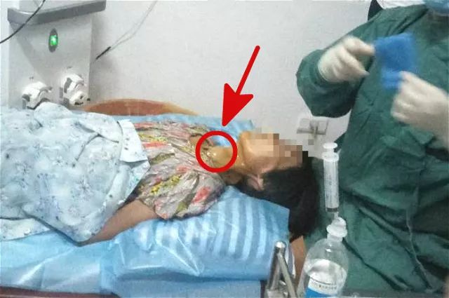 甲狀腺結(jié)節(jié)4A持續(xù)二十年，深入了解與管理，甲狀腺結(jié)節(jié)二十年持續(xù)觀察與管理策略