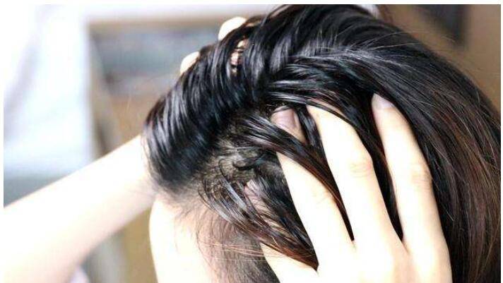 油性頭發(fā)去油小竅門(mén)，輕松告別油膩，煥發(fā)清爽光彩，油性頭發(fā)去油小竅門(mén)，告別油膩，煥發(fā)清爽光彩秘籍